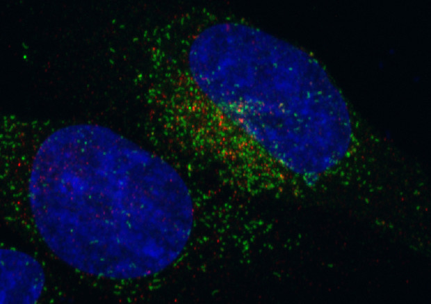 Scoperto il segreto della ‘droga’ dei tumori