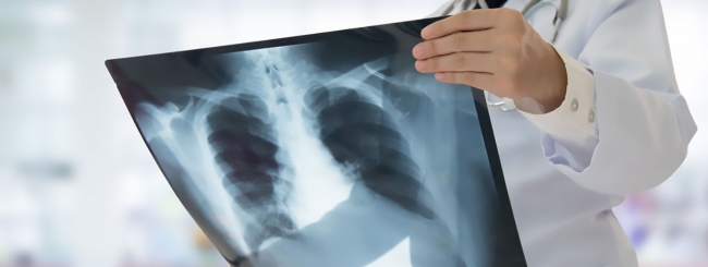 Salerno. Radiografia sbagliata, sei persone indagate