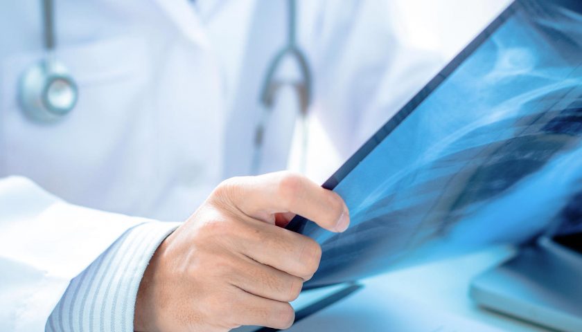Sanità, le radiografie a pagamento: superati i tetti di spesa