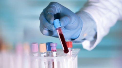 SANITA’, SIGLATA L’INTESA SINDACALE. INDENNITA’ PER INFERMIERI E OPERATORI SOCIO SANITARI