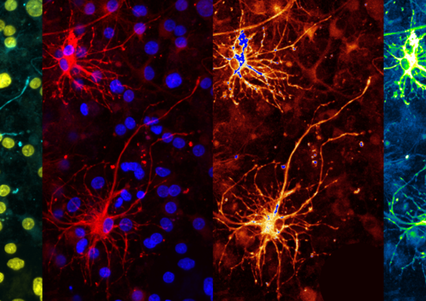 Scoperti i neuroni specchio delle emozioni