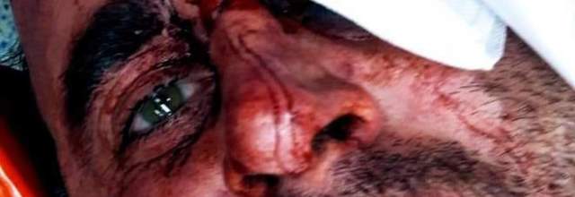 Massimo Castella, il commerciante massacrato di botte per pochi euro