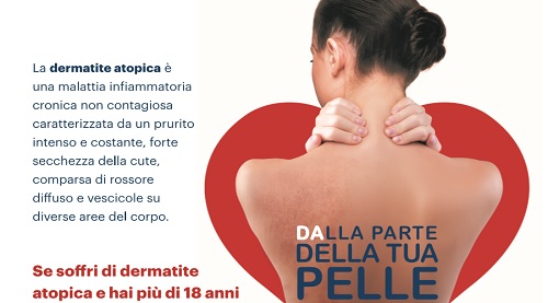 Il 31 ottobre al PO di Battipaglia visite dermatologioche gratuite per chi soffre di dermatite atopica