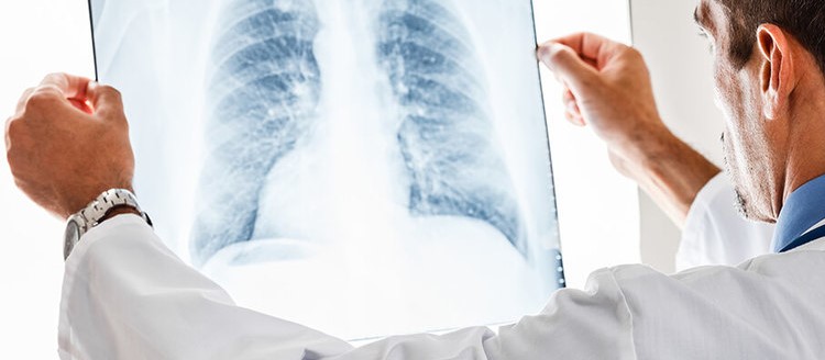 Domani al via “PneumoSalerno 2019” dedicato alla valutazione e gestione del paziente con patologie respiratorie