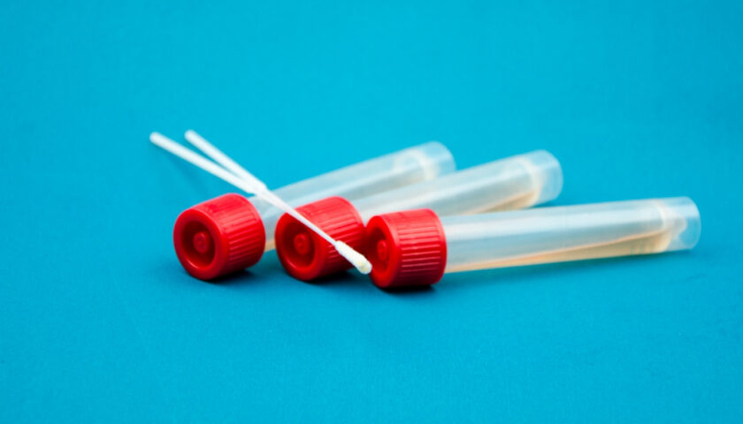 DIAGNOSI CORONAVIRUS, DA LUNEDÌ TEST RAPIDO A MONTECORVINO PUGLIANO