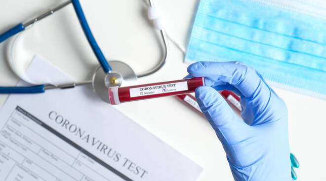 Test seriologici per coronavirus cosa sono e a cosa servono