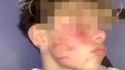 Sfida autolesionista su Tik Tok: interviene il garante