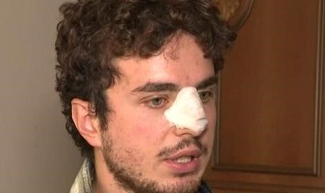 Professore di sostegno di Salerno picchiato da studenti in una scuola di Carpi