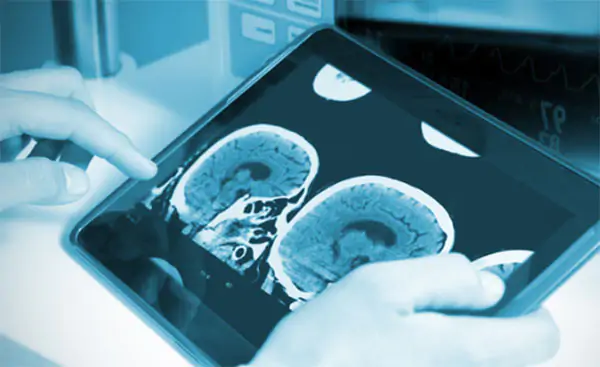 Si consolida l’utilizzo della Telestroke: altre tre trombolisi in telemedicina a Sapri e Polla