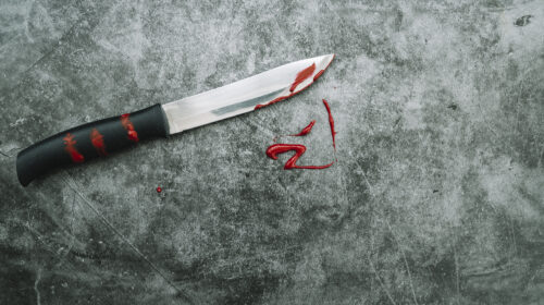 NON FARMI ARRABBIARE CHE TI DO UNA FORBICIATA