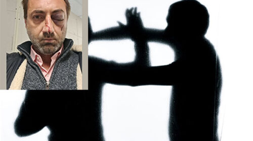 Vallo della Lucania, medico denuncia aggressione nel giorno di San Silvestro