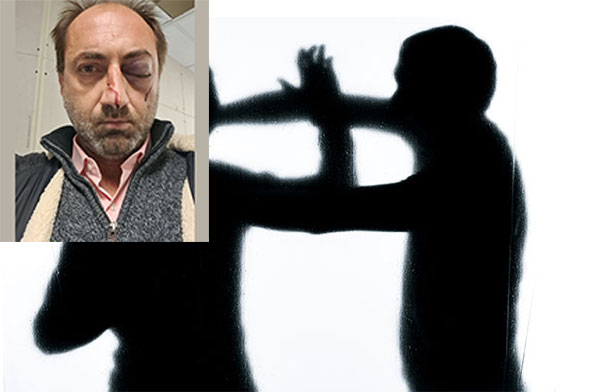 Vallo della Lucania, medico denuncia aggressione nel giorno di San Silvestro