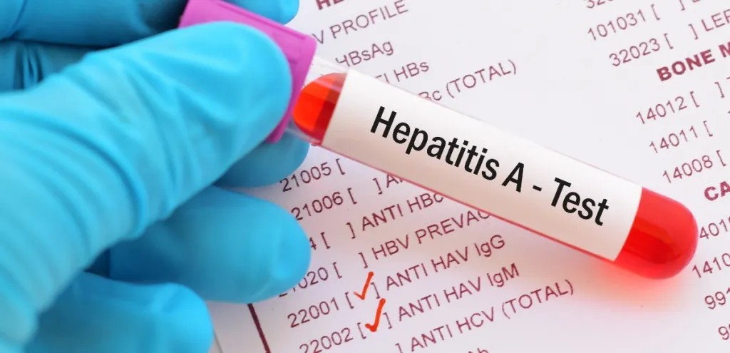 Epatite A, 12 contagiati a Salerno e provincia: avrebbero mangiato frutti di mare